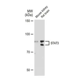 Anti-STAT3 antibody [GT1159] used in Western Blot (WB). GTX01294