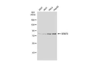 Anti-STAT3 antibody [GT1159] used in Western Blot (WB). GTX01294