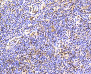 Anti-SMAD5 (phospho Ser463/Ser465) antibody [SY09-03] used in IHC (Paraffin sections) (IHC-P). GTX01450
