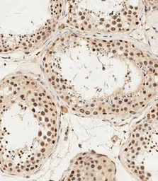 Anti-ALKBH5 antibody used in IHC (Paraffin sections) (IHC-P). GTX01525