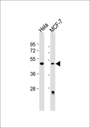 Anti-ALKBH5 antibody used in Western Blot (WB). GTX01525
