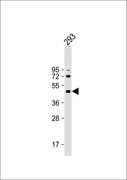 Anti-ALKBH5 antibody used in Western Blot (WB). GTX01525