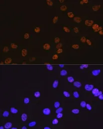 Anti-HDAC2 antibody [GT1219] used in Immunocytochemistry/ Immunofluorescence (ICC/IF). GTX01527
