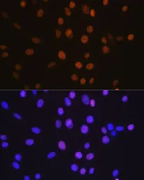Anti-HDAC2 antibody [GT1219] used in Immunocytochemistry/ Immunofluorescence (ICC/IF). GTX01527