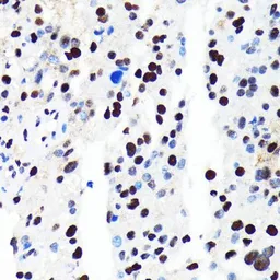 Anti-HDAC2 antibody [GT1219] used in IHC (Paraffin sections) (IHC-P). GTX01527