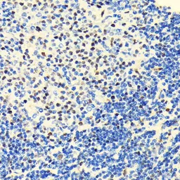 Anti-HDAC2 antibody [GT1219] used in IHC (Paraffin sections) (IHC-P). GTX01527
