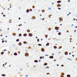 Anti-HDAC2 antibody [GT1219] used in IHC (Paraffin sections) (IHC-P). GTX01527