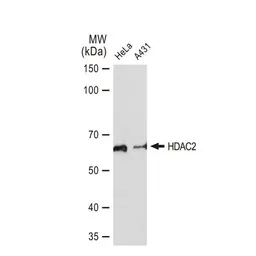 Anti-HDAC2 antibody [GT1219] used in Western Blot (WB). GTX01527