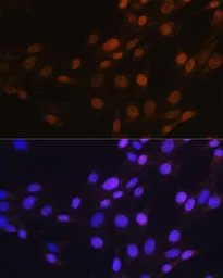 Anti-SP1 antibody [GT1220] used in Immunocytochemistry/ Immunofluorescence (ICC/IF). GTX01528