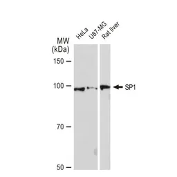 Anti-SP1 antibody [GT1220] used in Western Blot (WB). GTX01528