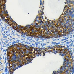 Anti-cIAP1 antibody [GT1222] used in IHC (Paraffin sections) (IHC-P). GTX01530