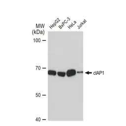 Anti-cIAP1 antibody [GT1222] used in Western Blot (WB). GTX01530