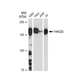 Anti-FANCD2 antibody [GT1223] used in Western Blot (WB). GTX01531