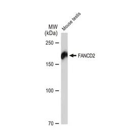 Anti-FANCD2 antibody [GT1223] used in Western Blot (WB). GTX01531