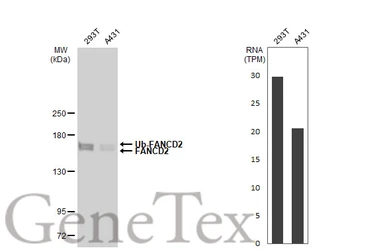 Anti-FANCD2 antibody [GT1223] used in Western Blot (WB). GTX01531
