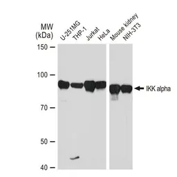 Anti-IKK alpha antibody [GT1224] used in Western Blot (WB). GTX01532