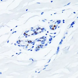 Anti-Androgen Receptor antibody [GT1228] used in IHC (Paraffin sections) (IHC-P). GTX01536