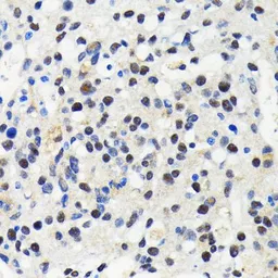 Anti-Cullin 3 antibody [GT1229] used in IHC (Paraffin sections) (IHC-P). GTX01537