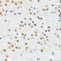 Anti-Cullin 3 antibody [GT1229] used in IHC (Paraffin sections) (IHC-P). GTX01537