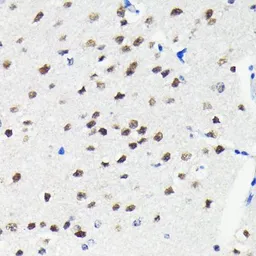 Anti-Cullin 3 antibody [GT1229] used in IHC (Paraffin sections) (IHC-P). GTX01537
