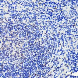 Anti-ATM antibody [GT1218] used in IHC (Paraffin sections) (IHC-P). GTX01544