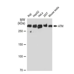 Anti-ATM antibody [GT1218] used in Western Blot (WB). GTX01544