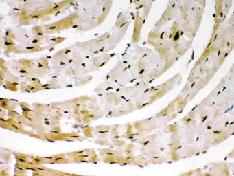 Anti-SIRT6 antibody used in IHC (Paraffin sections) (IHC-P). GTX01549