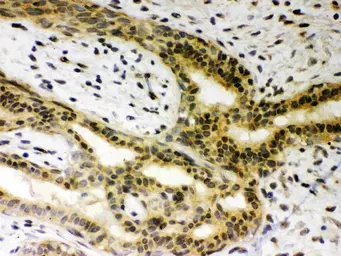 Anti-SIRT6 antibody used in IHC (Paraffin sections) (IHC-P). GTX01549