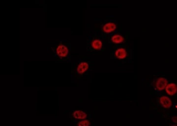 Anti-PARP2 antibody used in Immunocytochemistry/ Immunofluorescence (ICC/IF). GTX01558