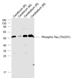Anti-Tau (phospho Thr231) antibody used in Western Blot (WB). GTX01563