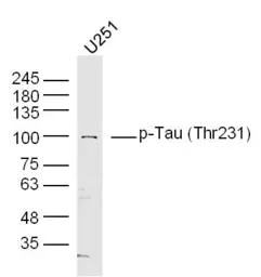 Anti-Tau (phospho Thr231) antibody used in Western Blot (WB). GTX01563