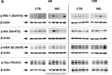 Anti-Tau (phospho Thr231) antibody used in Western Blot (WB). GTX01563