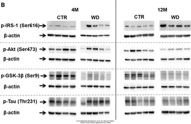 Anti-Tau (phospho Thr231) antibody used in Western Blot (WB). GTX01563