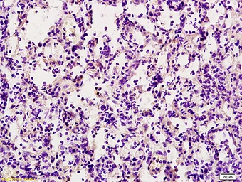 Anti-TRAIL antibody used in IHC (Paraffin sections) (IHC-P). GTX01564
