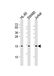 Anti-Kiss1 antibody used in Western Blot (WB). GTX01566