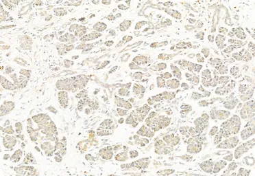 Anti-DRP1 (phospho Ser637) antibody used in IHC (Paraffin sections) (IHC-P). GTX01567