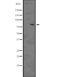 Anti-DRP1 (phospho Ser637) antibody used in Western Blot (WB). GTX01567
