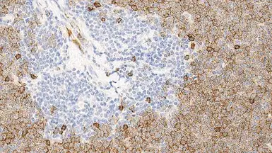 Mouse Anti-Human IgD antibody [DRN1C]. GTX01853
