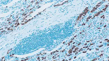Anti-Surfactant Protein A antibody [32E12] used in IHC (Paraffin sections) (IHC-P). GTX01854
