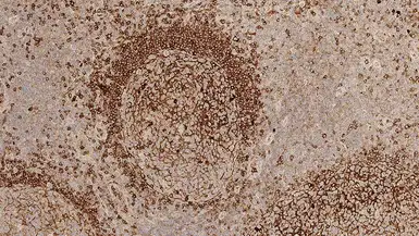 Mouse Anti-Human IgM antibody [8H6]. GTX01856