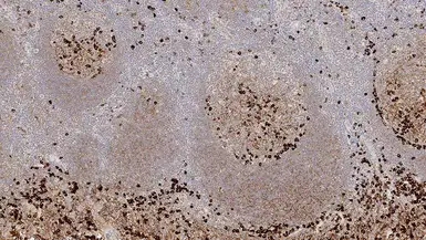 Mouse Anti-Human IgG antibody [RWP49]. GTX01858