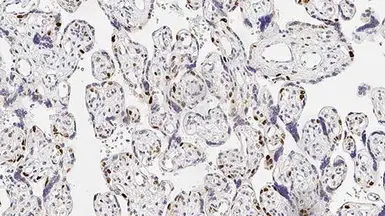 Anti-p57 Kip2 antibody [25B2] used in IHC (Paraffin sections) (IHC-P). GTX01862
