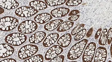 Anti-Villin antibody [CWWB1] used in IHC (Paraffin sections) (IHC-P). GTX01866