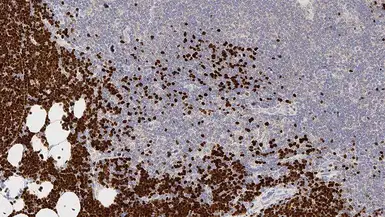Anti-TdT antibody [SEN28] used in IHC (Paraffin sections) (IHC-P). GTX01873