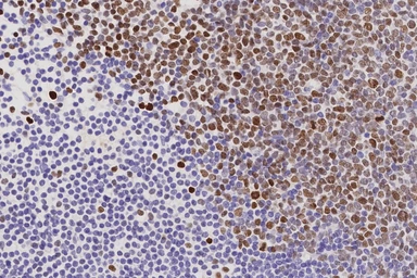 Anti-EZH2 antibody [6A10] used in IHC (Paraffin sections) (IHC-P). GTX01878