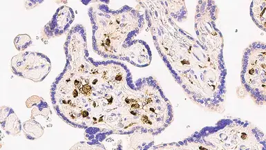 Anti-Factor XIIIa antibody [E980.1] used in IHC (Paraffin sections) (IHC-P). GTX01879