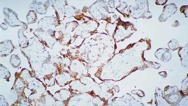 Anti-VEGF Receptor 3 antibody [KLT9] used in IHC (Paraffin sections) (IHC-P). GTX01880