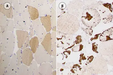 Anti-Myotilin antibody [RSO34] used in IHC (Paraffin sections) (IHC-P). GTX01881