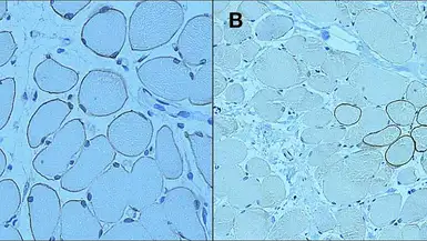 Anti-Dystrophin antibody [13H6] used in IHC (Paraffin sections) (IHC-P). GTX01888