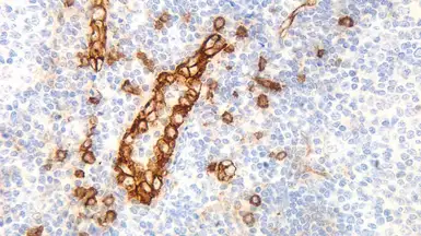 Anti-IL3 Receptor alpha antibody [BR4MS] used in IHC (Paraffin sections) (IHC-P). GTX01890